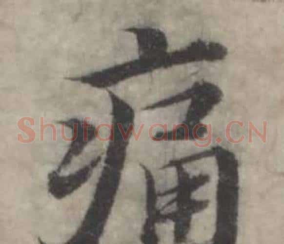 痛